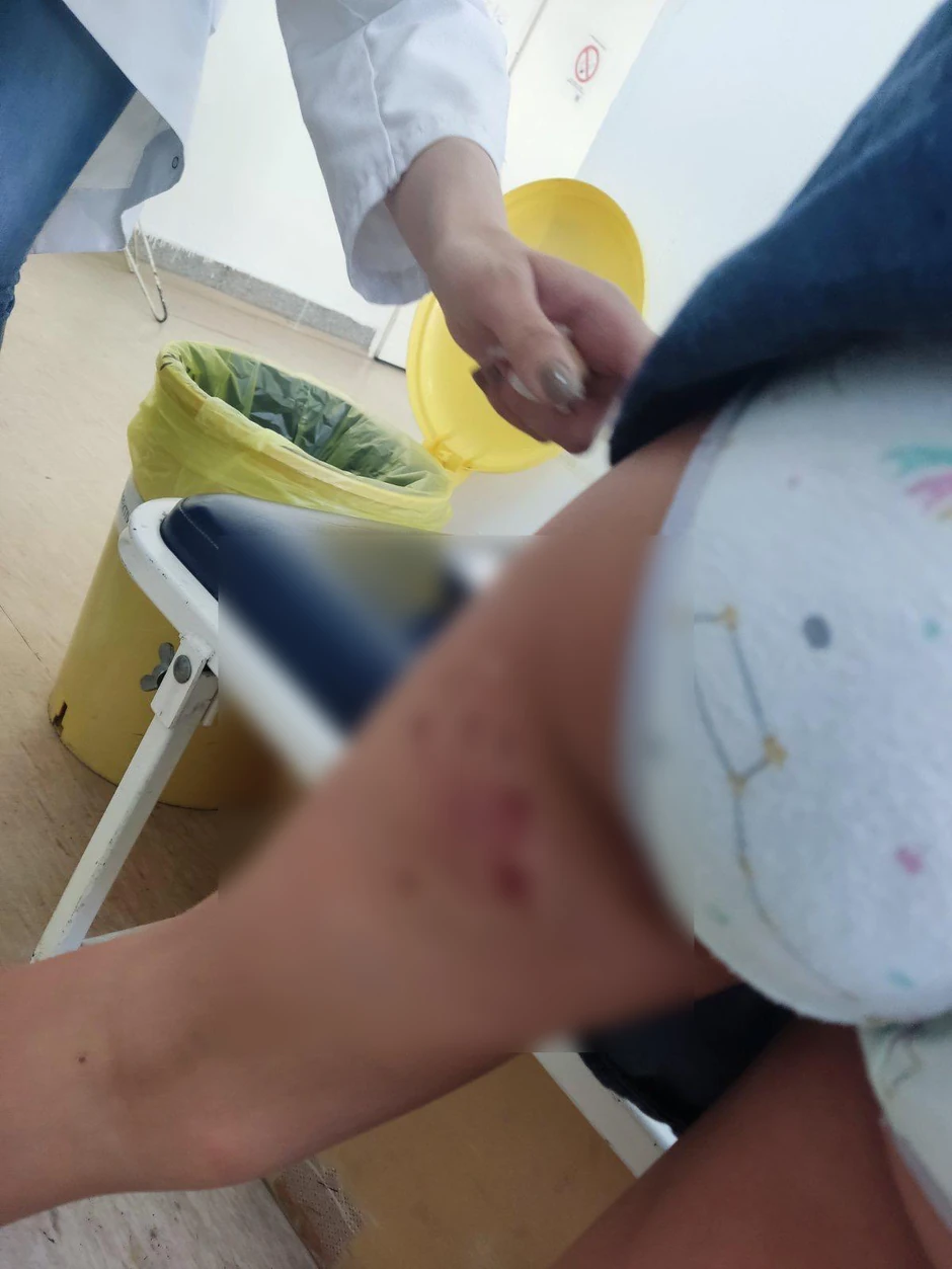 Posle napada psa devojčica satima nije mogla da govori od straha i šoka