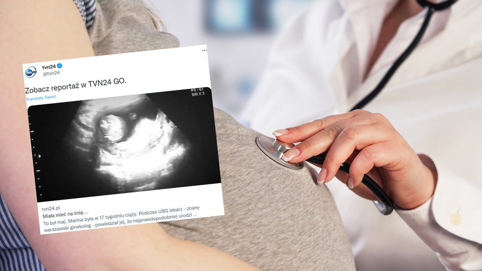 Lekarz nie powiedział, że płód nie ma czaszki. Dowiedziała się w 30. tygodniu (Screen: Twitter/tvn24)
