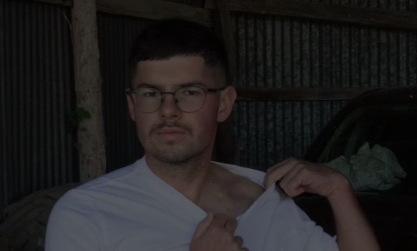 Tom pokazuje ranu od vazdušnog jastuka