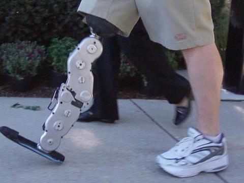 Bioniczna proteza nogi