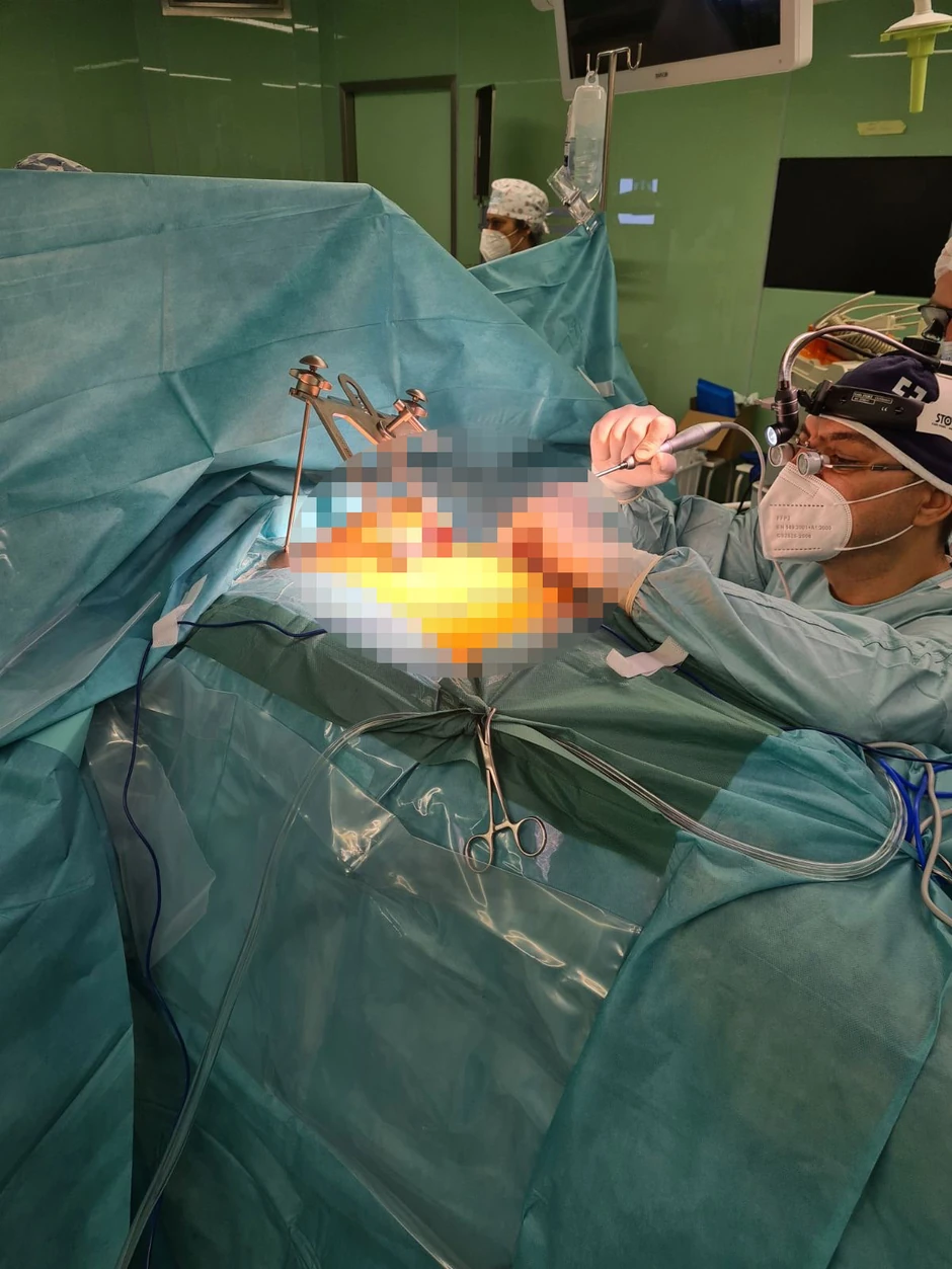 Operacija kardiohirgija KCS