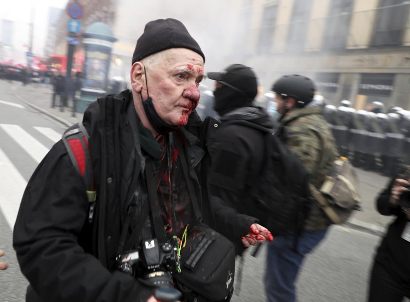 Marsz Niepodległości. Legendarny fotoreporter postrzelony w twarz