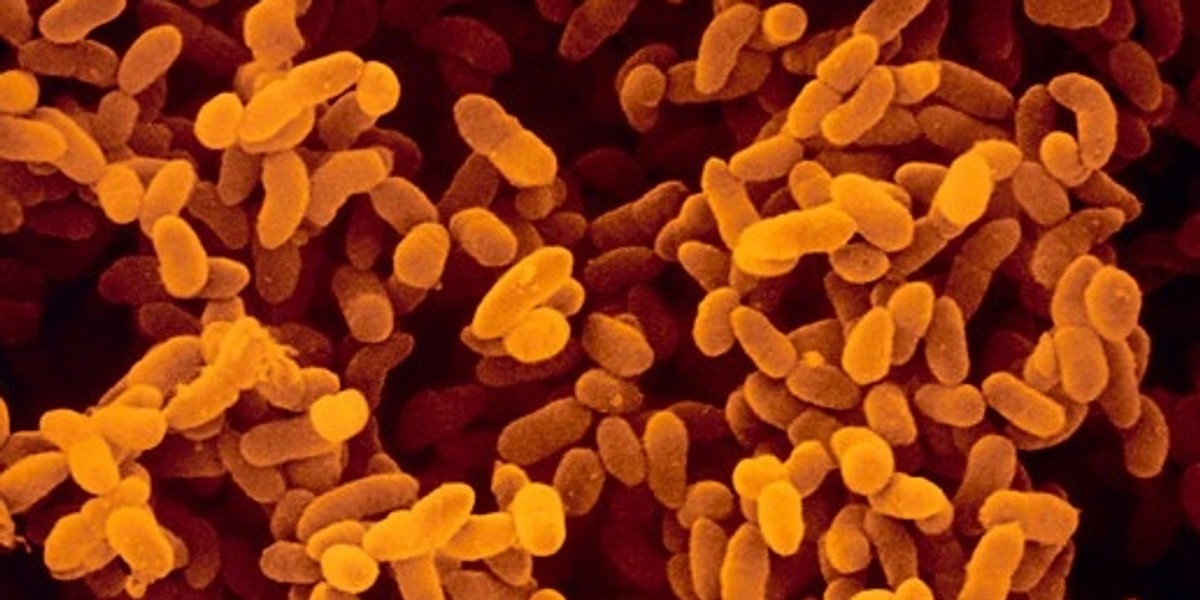 Klebsiella pneumoniae