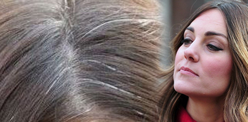 Księżna Kate ma siwe włosy. Szok!