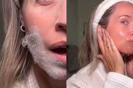 Žene poludele za najluđom tehnikom BRIJANJA LICA: Prskaju se ŠAMPONOM ZA SUVO PRANJE i izgledaju kao Deda Mraz, pa se nakon žileta kunu da im lice NIKADA BOLJE nije izgledalo