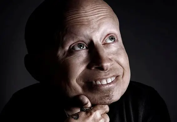 Nie żyje Verne Troyer. Rodzina podała przyczynę śmierci aktora