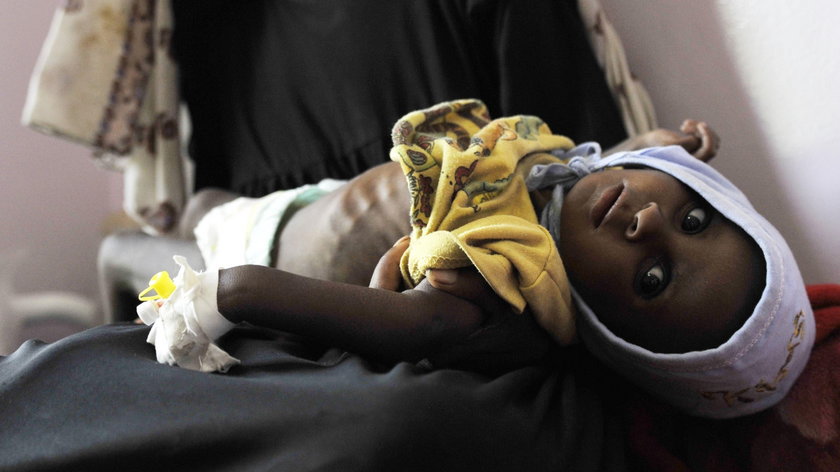 7,5 mln dzieci umiera z głodu