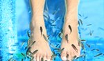 Fish pedicure. To działa?