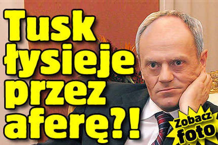 Tusk łysieje przez aferę?! ZOBACZ ZDJĘCIA