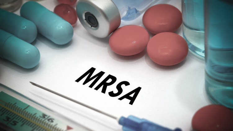 MRSA tünet vizsgálat kezelés