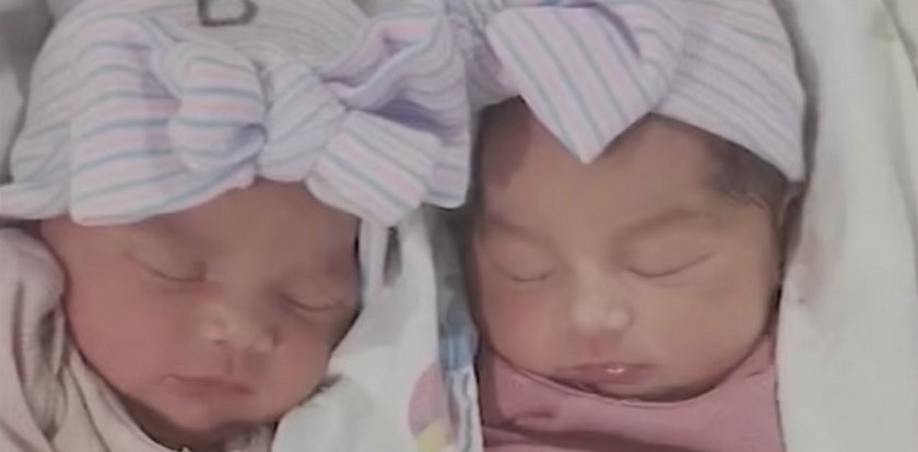 Koszmar nowonarodzonych bliźniaczek. Rodzice doprowadzili je do śmierci