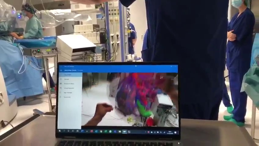 Zastosowanie okularów HoloLens na sali operacyjnej