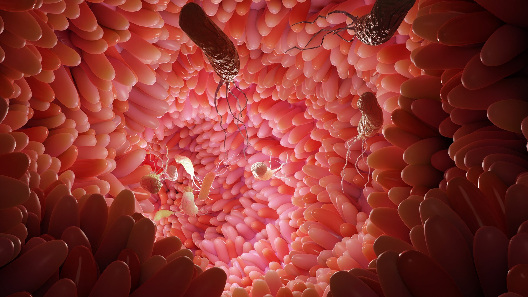 Helicobacter pylori infects the gastric mucosa. (illustration photo)