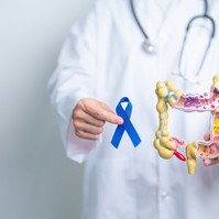Egyre nő a fiatal vastagbélrákos esetek száma - az onkológus szerint ez lehet az oka