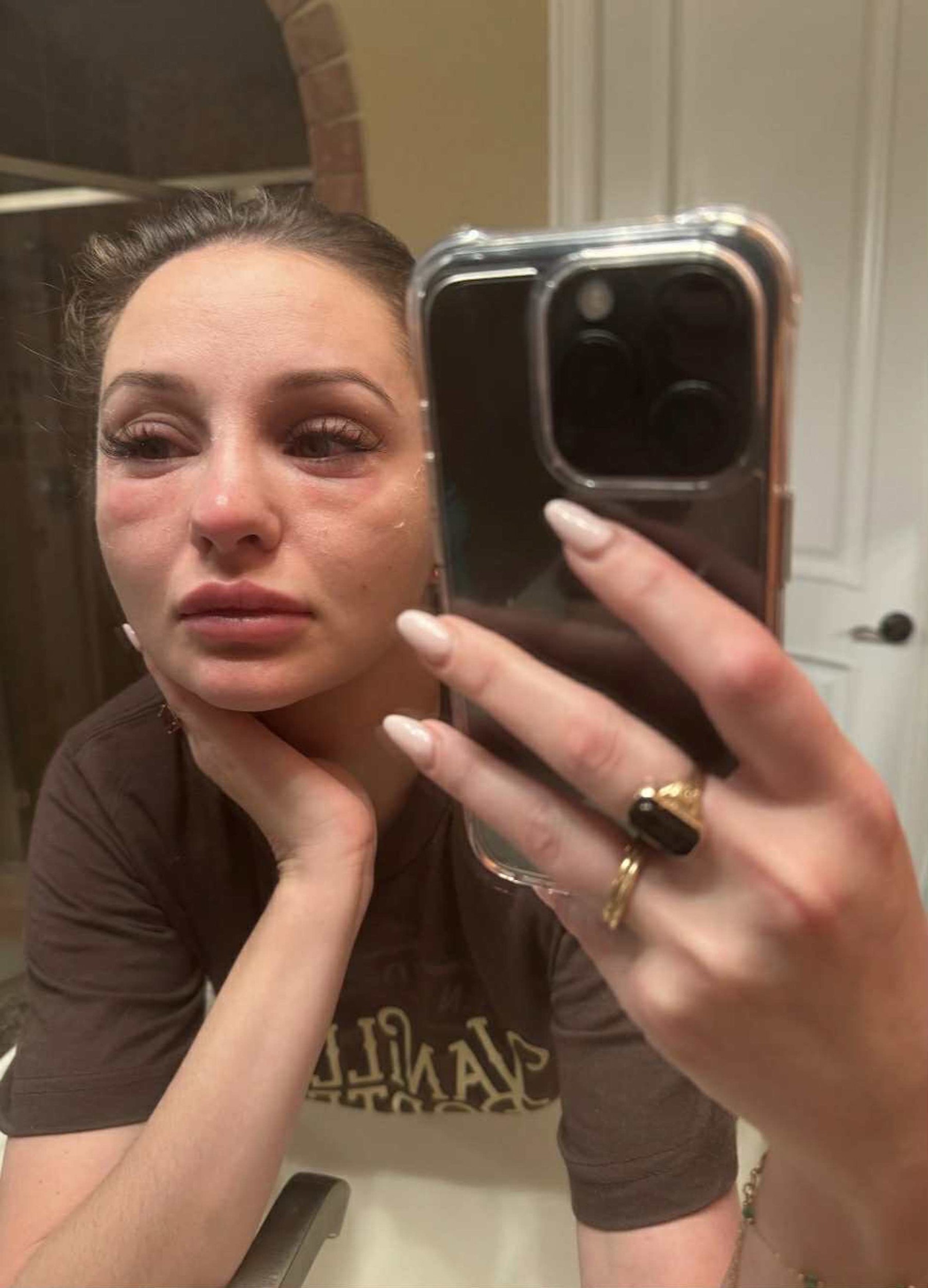 Mercedes Brooke takmer zomrela kvôli plesni v byte. 