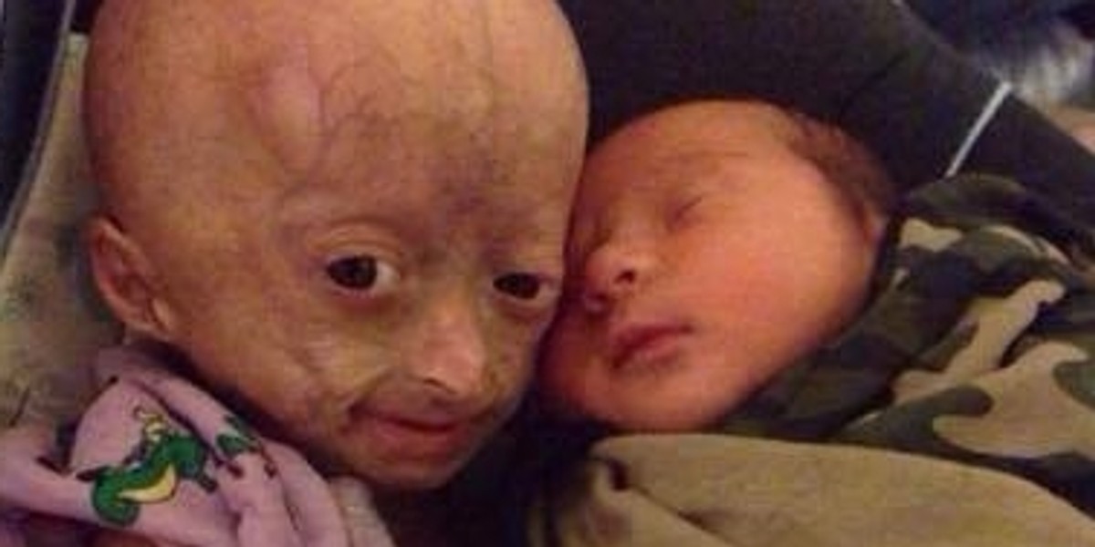 Adalia Rose.