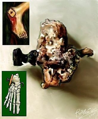 La patología de la crucifixión todavía se está investigando en la ciencia médica hoy.