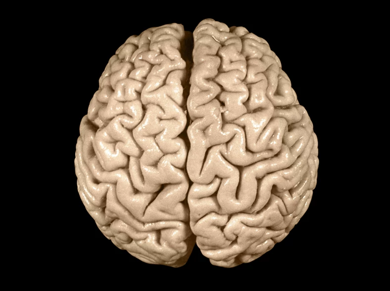 Zdjęcie mózgu Alberta Einsteina. Widok od góry (1955)