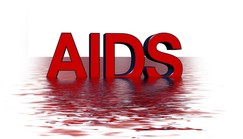 These are the only 2 times you can get HIV/AIDS through kissing