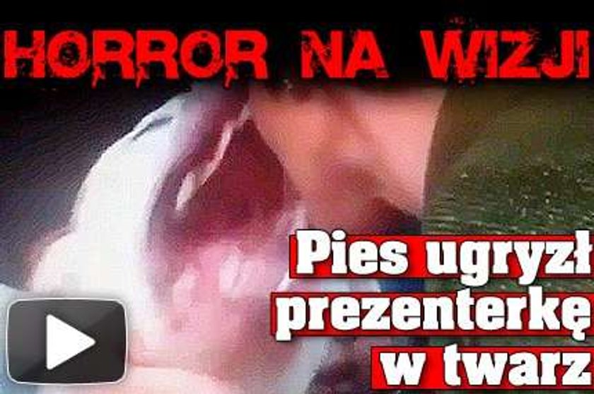 Horror na wizji. Pies ugryzł prezenterkę w twarz. FILM