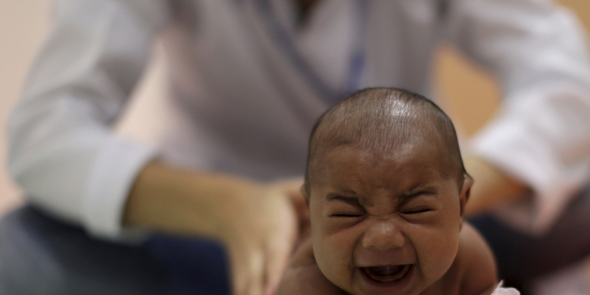 Pietro Rafael, who has microcephaly, reacts to stimulus during an evaluation session with a physiotherapist at the Altino Ventura rehabilitation center in Recife, Brazil.