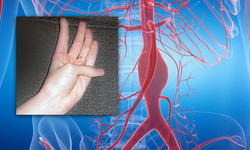 Test kciuka pozwoli wykryć, czy grozi ci tętniak aorty