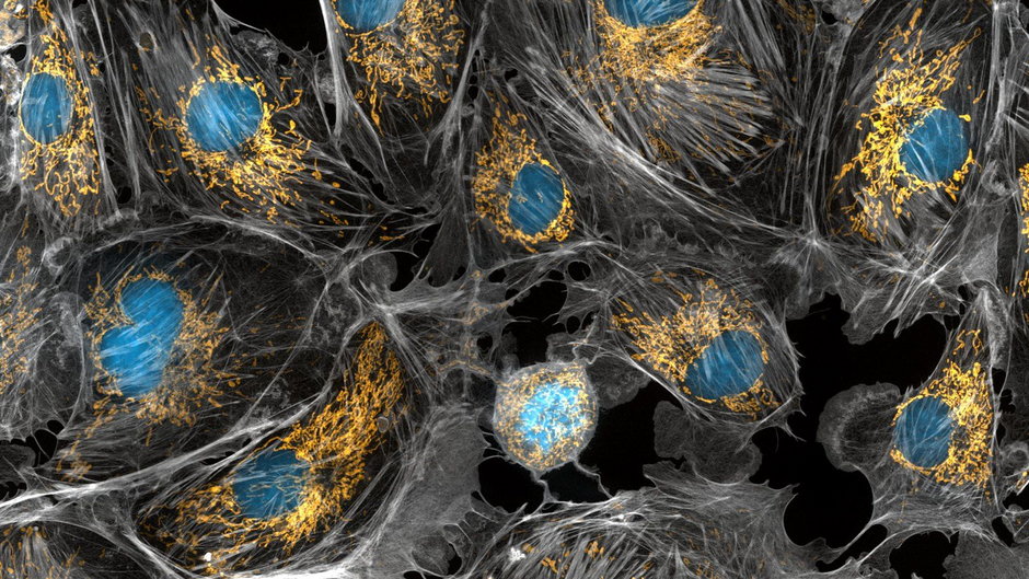 Krowie komórki z zaznaczonymi na złoto mitochondriami