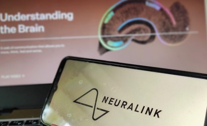 Agyi chip beültetése emberbe: "még az idén sor kerül az elsőre"