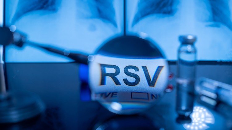 mrns vakcina hatása RSV vizsgálat gyermekek