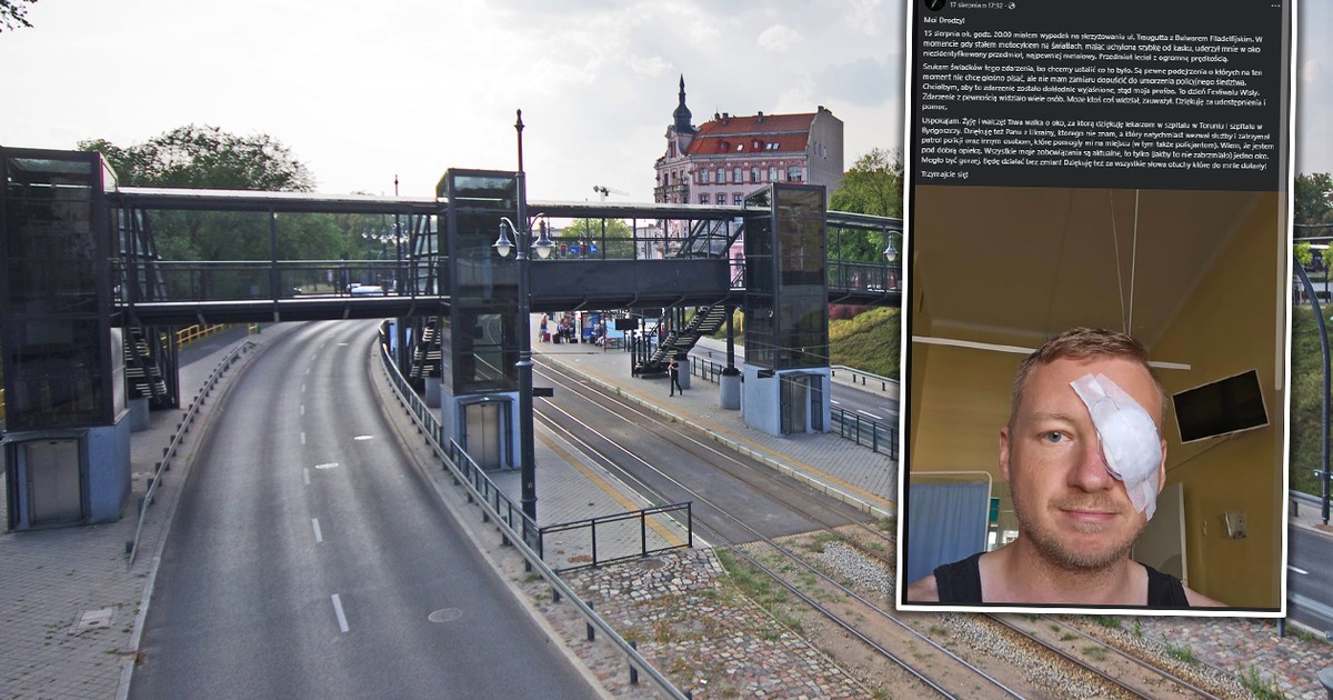Ktoś strzela do motocyklistów w Toruniu. Wśród poszkodowanych dziennikarz. "Z oka wyjęto mi śrut"