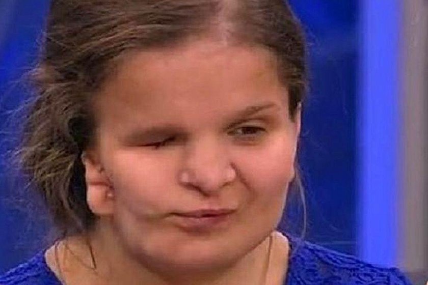 Katia Badajewa umarła w trakcie operacji plastycznej