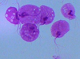 trichomonas-d000014B97fef984bbf59