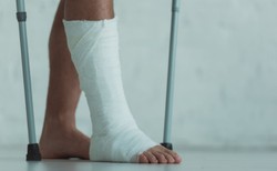 Aż pół tony gipsu użyto podczas ferii zimowych w zakopiańskim szpitalu