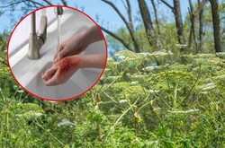 Barszcz Sosnowskiego to wyjątkowo niebezpieczna roślina. Gdy ją zobaczysz zgłoś to do Straży Miejskiej