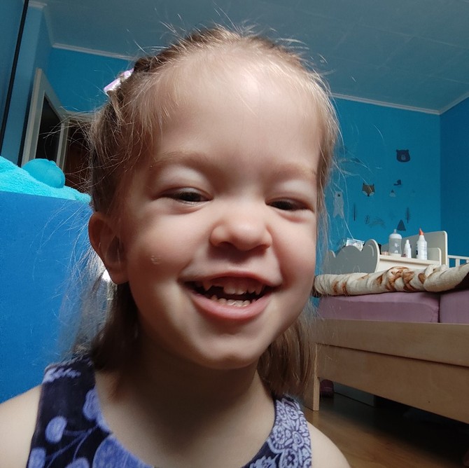 Staša Terzin takođe ima ahondroplaziju