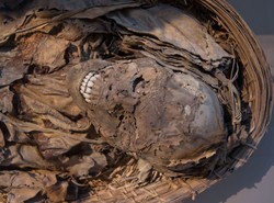 Choroby serca wcale nie są współczesne. Były też w starożytności