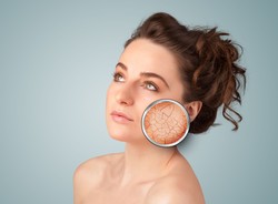 Kiedy skóra jest odwodniona a kiedy sucha? Jak je pielęgnować?