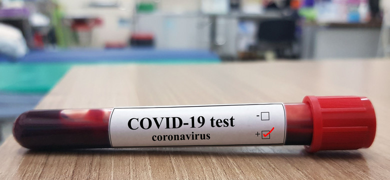 Testy na koronawirusa w dyskontach i drogeriach. Tyle że w Niemczech