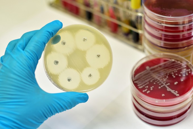 Antibiotikum rezisztencia: ezért van köze a koronavírushoz!