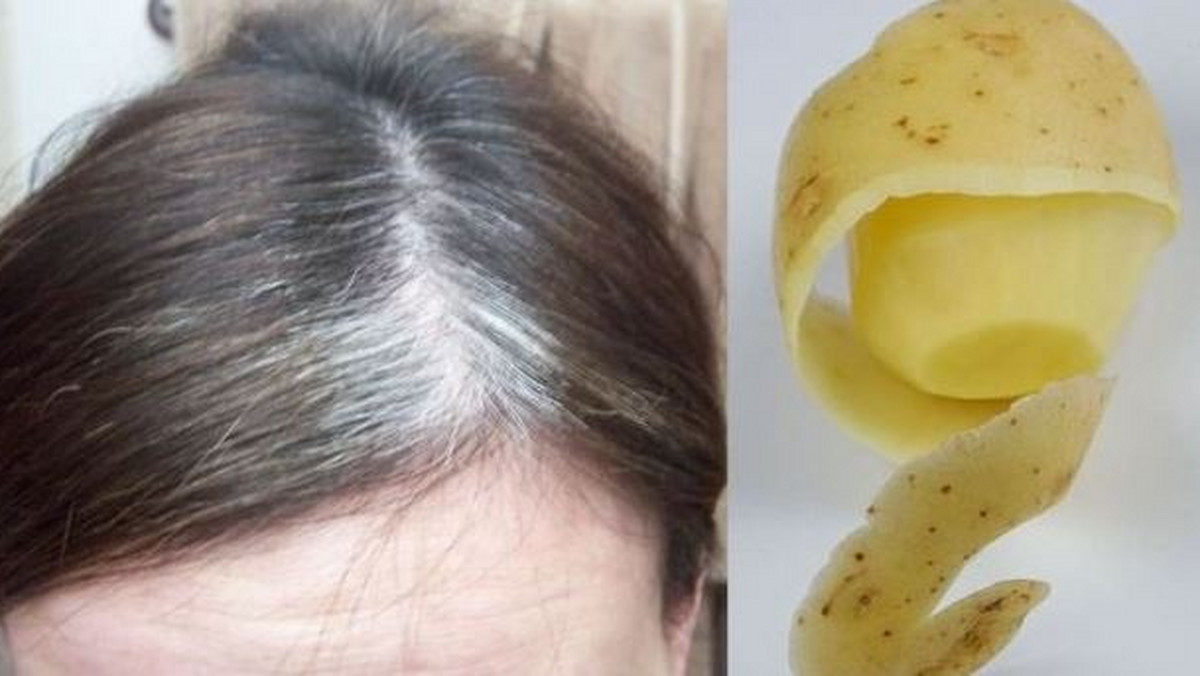 Na waszej głowie pojawiają się siwe włosy i nie macie pomysłu, jak się ich pozbyć? Zapomnijcie o farbach do włosów i wypróbujcie naturalną metodę, jaką są obierki z ziemniaków.