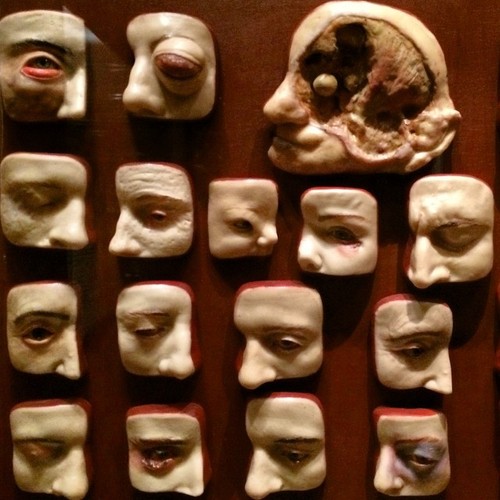 Przykłady chorób oczu.