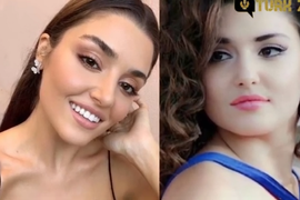 Ovako su NAJVEĆE LEPOTICE U TURSKOJ izgledale pre PLASTIČNIH OPERACIJA I NE ZNA ŠTA JE VEĆI ŠOK! Među njima i BIVŠA MIS ALBANIJE i nikome nije jasno što su ovo uradile