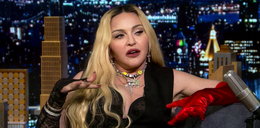 Madonna znowu szokuje. Fani jej zarzucają, że jest do siebie niepodobna i wygląda na 16 lat. Jej twarz ocenił ekspert!
