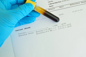 Mit jelent a kortizol érték a laborleleten?