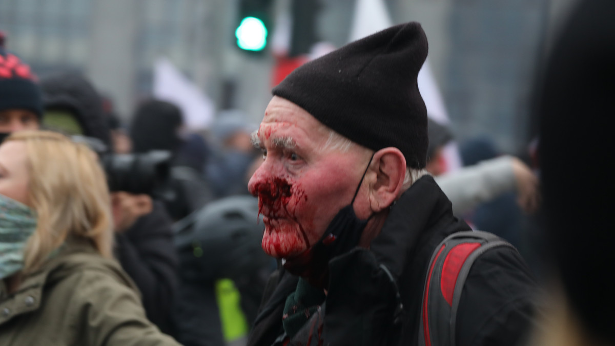 Marsz Niepodległości. Postrzelony fotoreporter Tomasz Gutry komentuje