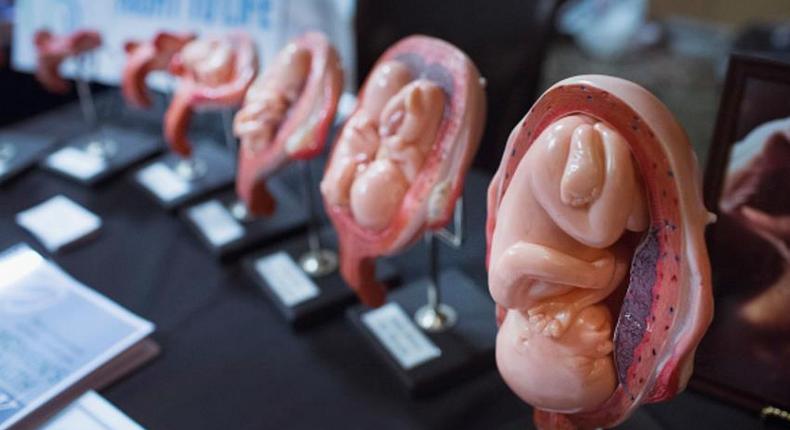 Over 41 million babies were terminated through abortion in 2018