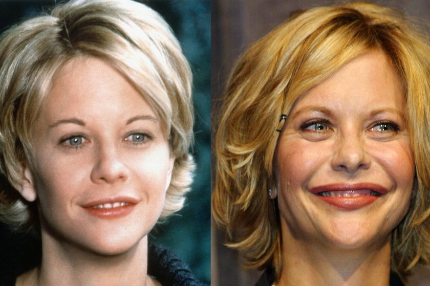 Meg Ryan kiedyś i teraz