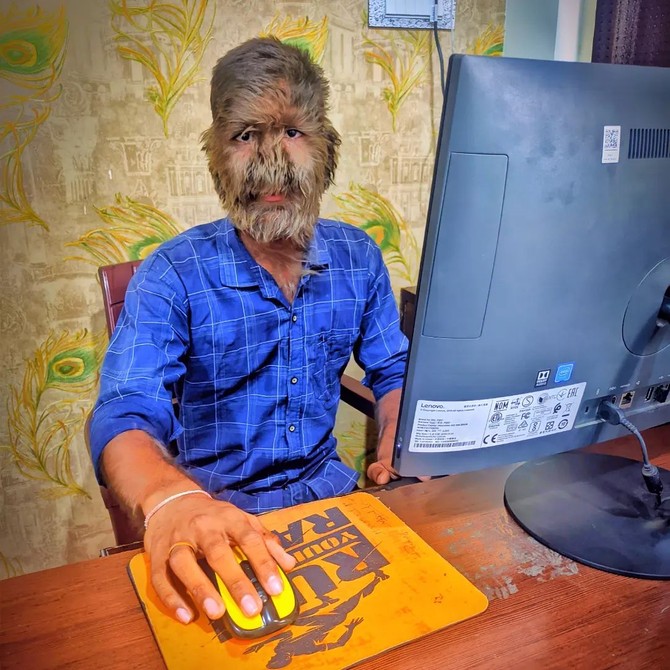 Lalit Patidar