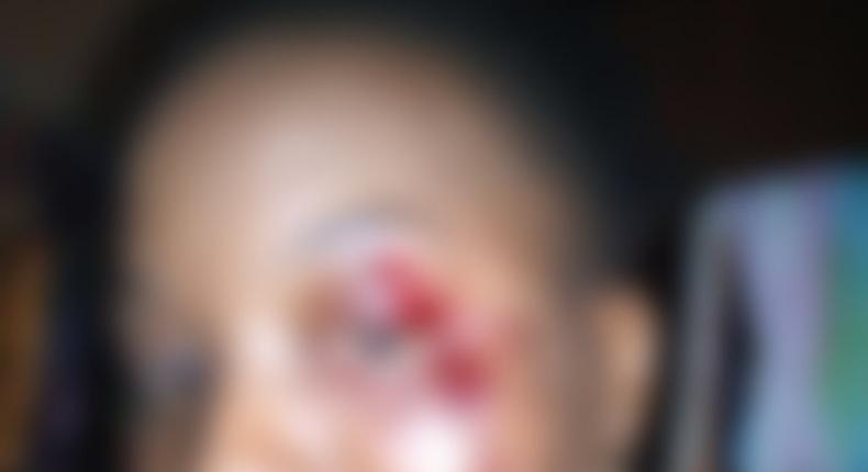A woman feels mistreated after receiving a damaging punch from a Nigerian soldier who was reportedly drunk at the time of their meeting.