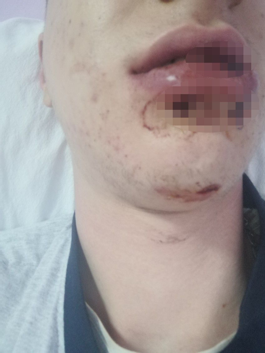 Fotografije lica pretučenog tinejdžera su uznemirujuće